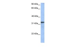 Aviva Systems Biology Corp ETFA Antibody - middle region (ARP54290_P050)