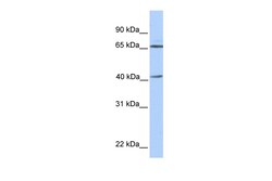 Aviva Systems Biology Corp GLA Antibody - N-terminal region (ARP54296_P050)