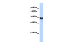 Aviva Systems Biology Corp LIG1 Antibody - middle region (ARP54307_P050)