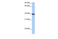 Aviva Systems Biology Corp APOA4 Antibody - C-terminal region (ARP54316_P050)