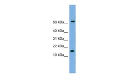 Aviva Systems Biology Corp IL1B Antibody - N-terminal region (ARP54323_P050)