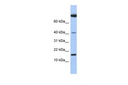 Aviva Systems Biology Corp IL4 Antibody - middle region (ARP54330_P050)