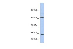 Aviva Systems Biology Corp IL9 Antibody - middle region (ARP54331_P050)