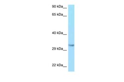Aviva Systems Biology Corp IGF2 Antibody - C-terminal region (ARP54342_P050)