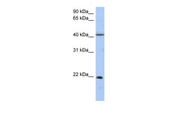 Aviva Systems Biology Corp GUK1 Antibody - middle region (ARP54358_P050)