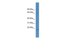 Aviva Systems Biology Corp LTA4H Antibody - N-terminal region (ARP54367_P050)