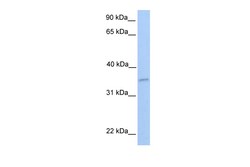 Aviva Systems Biology Corp NKIRAS2 Antibody - middle region (ARP54369_P050)