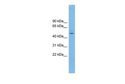 Aviva Systems Biology Corp NKAPL Antibody - middle region (ARP54392_P050)