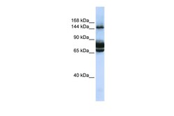 Aviva Systems Biology Corp FAM83B Antibody - C-terminal region (ARP54399_P050)