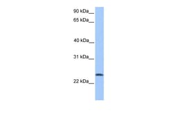 Aviva Systems Biology Corp RP11-269F19.9 Antibody - N-terminal region (ARP54425_P050)