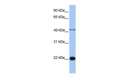 Aviva Systems Biology Corp C2orf68 Antibody - N-terminal region (ARP54429_P050)