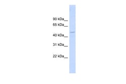 Aviva Systems Biology Corp DBNL Antibody - middle region (ARP54437_P050)