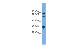 Aviva Systems Biology Corp SH3KBP1 Antibody - N-terminal region (ARP54453_P050)