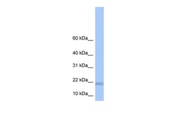 Aviva Systems Biology Corp LOC284009 Antibody - N-terminal region (ARP54457_P050)