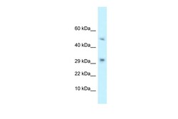 Aviva Systems Biology Corp D9Ertd402e Antibody - N-terminal region (ARP54464_P050)