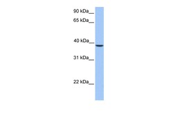 Aviva Systems Biology Corp SUNC1 Antibody - C-terminal region (ARP54470_P050)