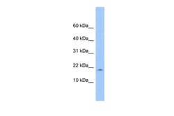Aviva Systems Biology Corp LOC285033 Antibody - N-terminal region (ARP54488_P050)