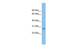 Aviva Systems Biology Corp C1orf104 Antibody - middle region (ARP54499_P050)