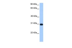Aviva Systems Biology Corp HAGH Antibody - C-terminal region (ARP54515_P050)