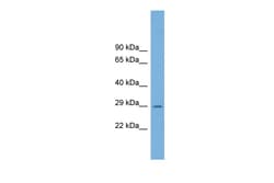 Aviva Systems Biology Corp C1orf43 Antibody - middle region (ARP54537_P050)