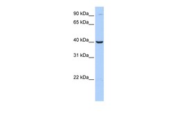 Aviva Systems Biology Corp ARG2 Antibody - C-terminal region (ARP54567_P050)