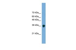 Aviva Systems Biology Corp FRZB Antibody - middle region (ARP54571_P050)