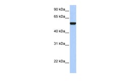 Aviva Systems Biology Corp IFRD1 Antibody - middle region (ARP54585_P050)