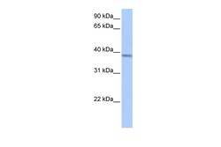Aviva Systems Biology Corp ACADSB Antibody - middle region (ARP54586_P050)