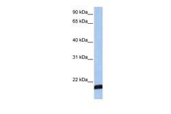 Aviva Systems Biology Corp ARF6 Antibody - middle region (ARP54598_P050)