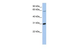 Aviva Systems Biology Corp FRK Antibody - middle region (ARP54618_P050)