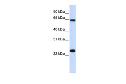 Aviva Systems Biology Corp KPNA1 Antibody - N-terminal region (ARP54670_P050)