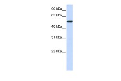 Aviva Systems Biology Corp KPNA3 Antibody - N-terminal region (ARP54674_P050)