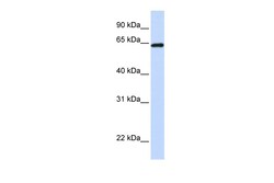 Aviva Systems Biology Corp LCP1 Antibody - C-terminal region (ARP54687_P050)