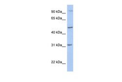 Aviva Systems Biology Corp PPM1J Antibody - C-terminal region (ARP54745_P050)