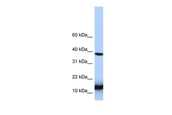 Aviva Systems Biology Corp HINT1 Antibody - N-terminal region (ARP54766_P050)