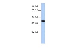 Aviva Systems Biology Corp LDHA Antibody - middle region (ARP54777_P050)