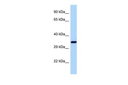 Aviva Systems Biology Corp Dnajb1 Antibody - C-terminal region (ARP54796_P050)