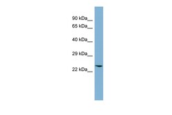 Aviva Systems Biology Corp GLO1 Antibody - N-terminal region (ARP54803_P050)