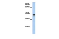 Aviva Systems Biology Corp LGALS9 Antibody - middle region (ARP54821_P050)