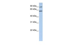 Aviva Systems Biology Corp CCT5 Antibody - N-terminal region (ARP54825_P050)