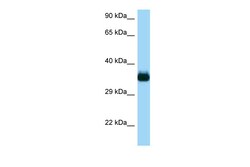 Aviva Systems Biology Corp Cdc42ep4 Antibody - middle region (ARP54840_P050)