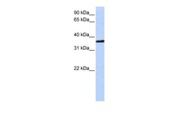 Aviva Systems Biology Corp CHORDC1 Antibody - middle region (ARP54844_P050)