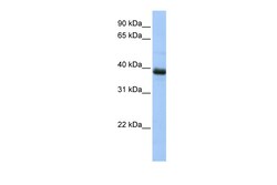 Aviva Systems Biology Corp SPO11 Antibody - N-terminal region (ARP54901_P050)