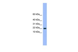 Aviva Systems Biology Corp NXT1 Antibody - N-terminal region (ARP54919_P050)