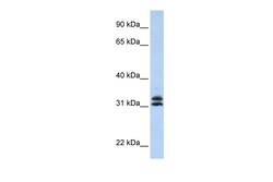 Aviva Systems Biology Corp PYCR2 Antibody - middle region (ARP54937_P050)