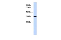 Aviva Systems Biology Corp RPA4 Antibody - middle region (ARP54941_P050)