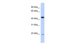 Aviva Systems Biology Corp NOB1 Antibody - N-terminal region (ARP54975_P050)