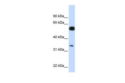 Aviva Systems Biology Corp C19orf62 Antibody - N-terminal region (ARP54986_P050)