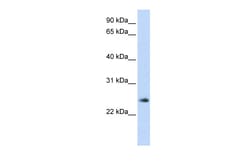 Aviva Systems Biology Corp THYN1 Antibody - middle region (ARP54988_P050)