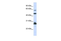 Aviva Systems Biology Corp PES1 Antibody - C-terminal region (ARP55008_P050)